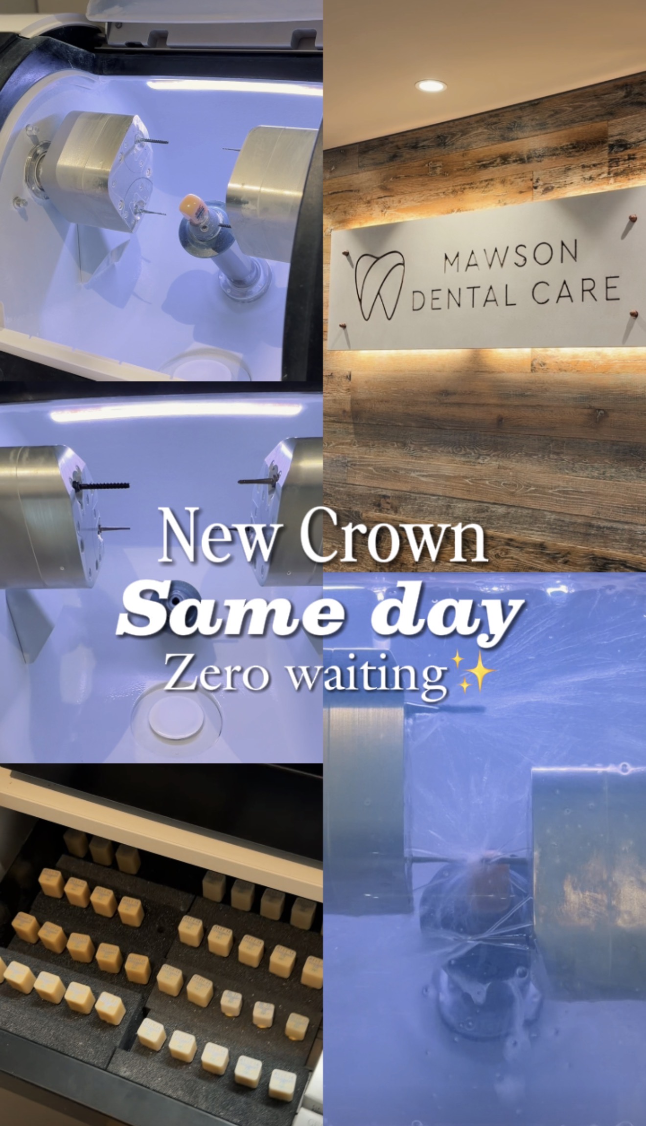 Same day crown thumbnail